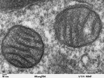 Description: http://upload.wikimedia.org/wikipedia/commons/thumb/0/0c/Mitochondria%2C_mammalian_lung_-_TEM.jpg/350px-Mitochondria%2C_mammalian_lung_-_TEM.jpg