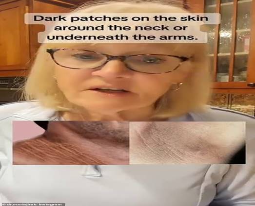 Dr Marla Jirak , a PhD educator and researcher in health, stress management and behaviour change, took to TikTok to list symptoms that could indicate a pre-diabetic body