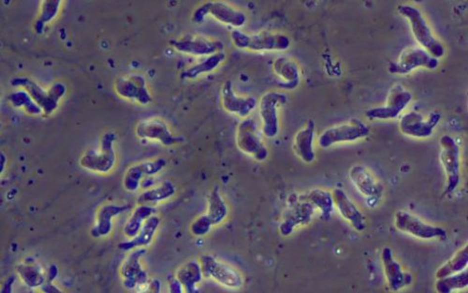 A microscopic view of the deadly Naegleria fowleri